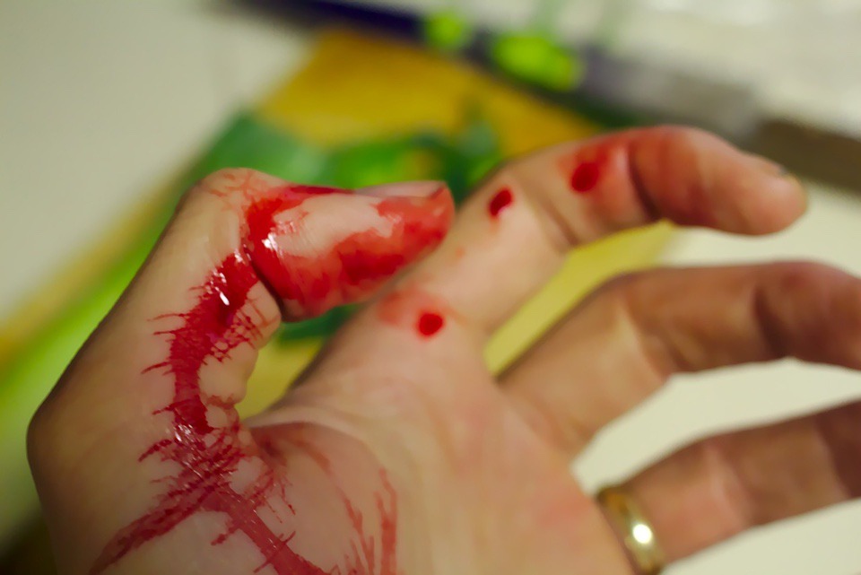 Hand-bleeding Online Courses